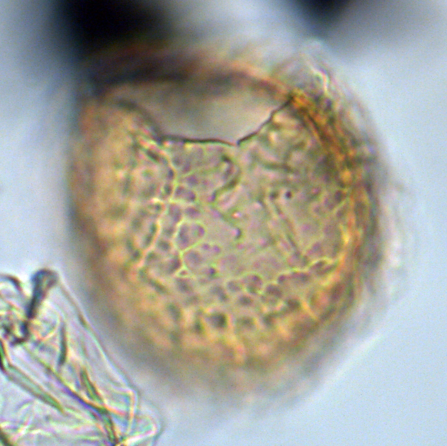 (Cassidium fragile), U1581-21R-4W, 114-119, sl. 2, N18, foto-d.jpg